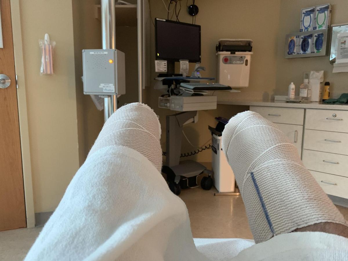 Surviving fourteener at the cost of amputation for Colorado father