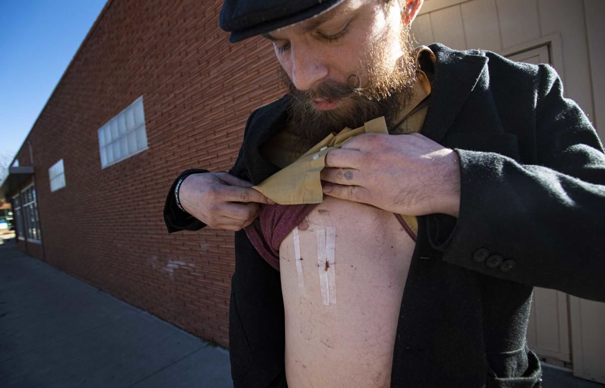 Trail stabbing suspect in Colorado charged with 41 counts