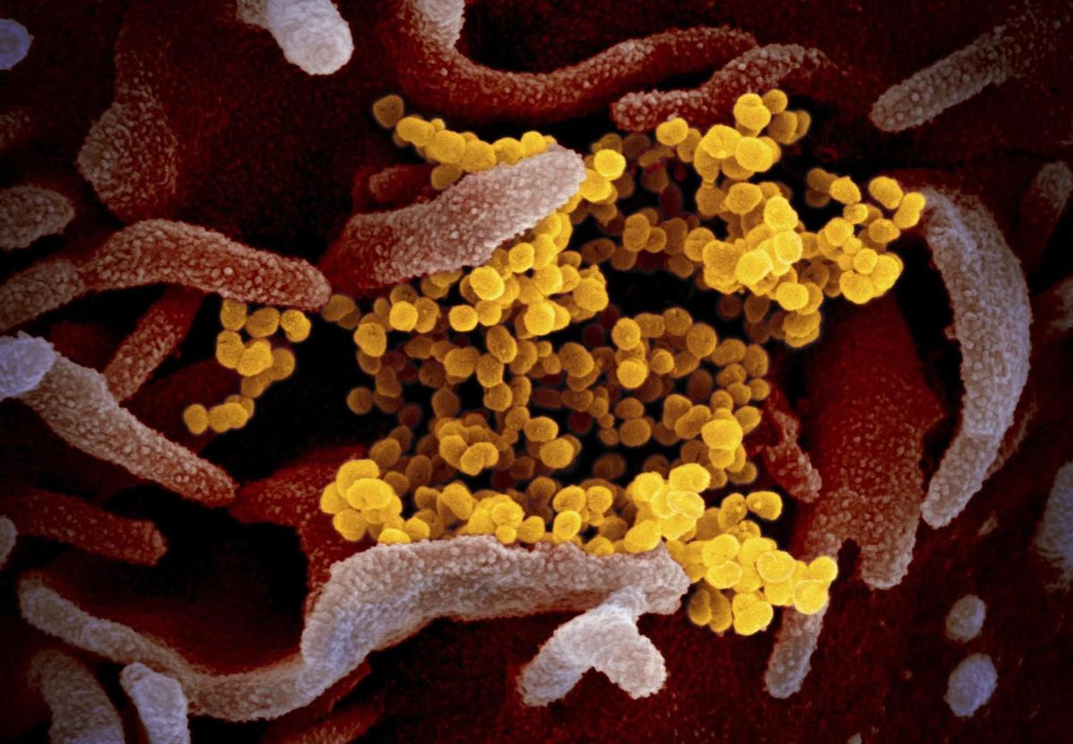 Coronavirus vs. the flu: Similar symptoms and the differences