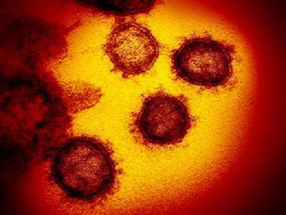 Recovered coronavirus patients can donate plasma to aid others battling the disease, UCHealth says
