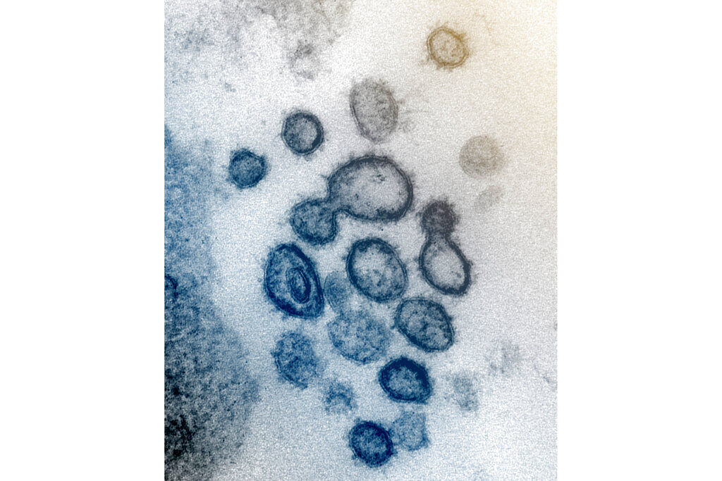 This undated electron microscope file image made available by the U.S. National Institutes of Health in February 2020 shows the Novel Coronavirus SARS-CoV-2. ((NIAID-RML via AP, file))