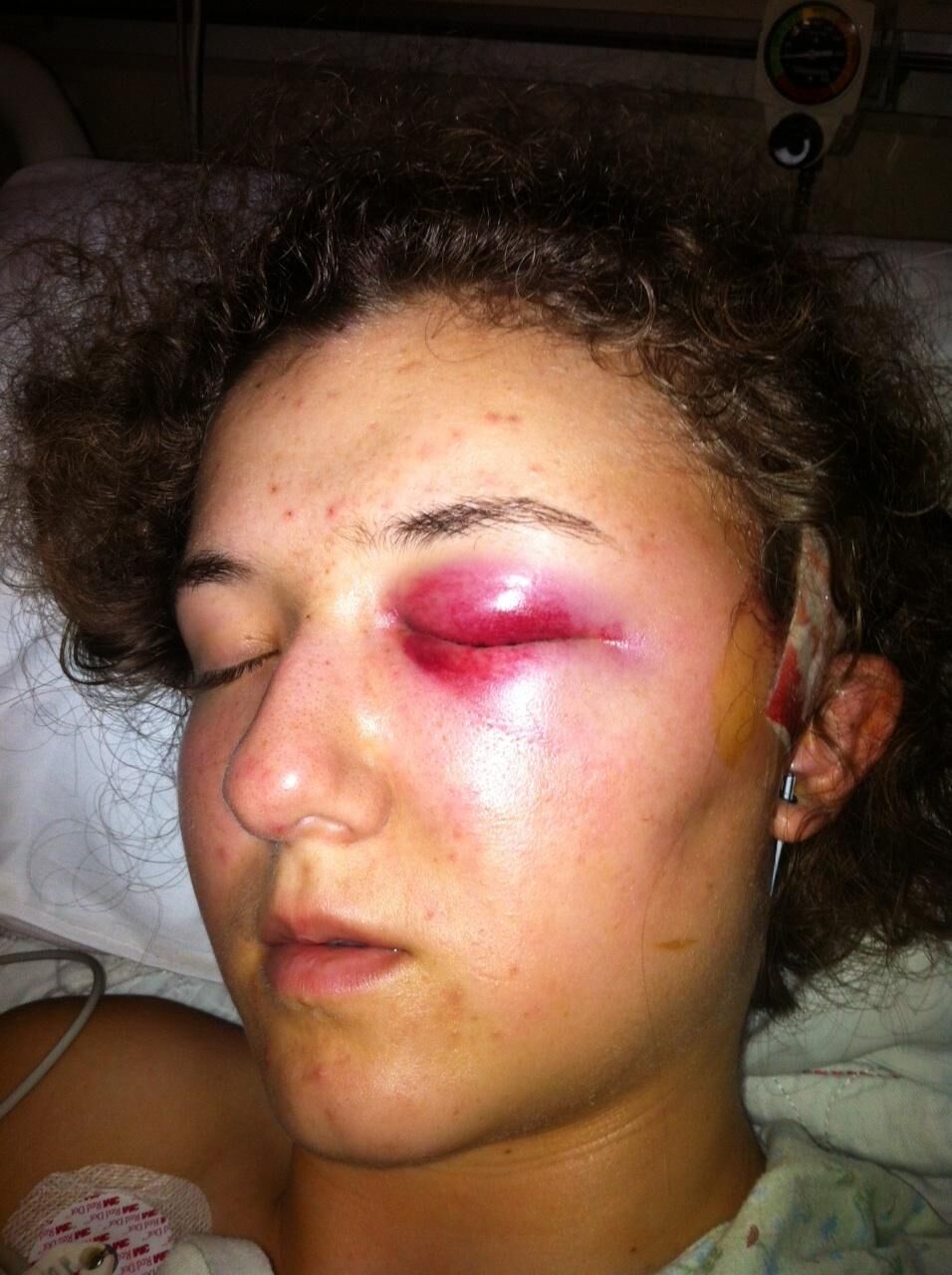 Brain surgery in 2012 forever changed life for twins Jesse and Tyler Youngwerth. Photo courtesy Tyler Youngwerth