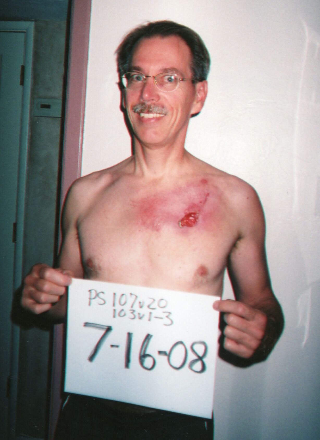 Mike Hoesch’s skin cancer receded after he believed God answered his prayers to be healed. (Courtesy photo)