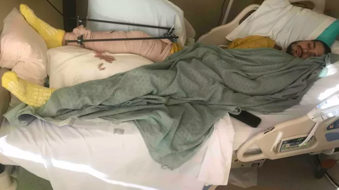 Man arrested, accused of breaking victim’s leg at Colorado Springs dog park, police say
