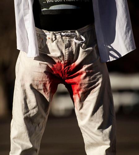021322-news-circumcision 07
