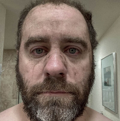 Phil Rosenberg-Watt after rescuing two dogs in the Marshall fire. (Photo courtesy Kelly Watt)