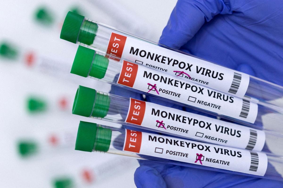 Colorado identifies 2nd apparent case of monkeypox