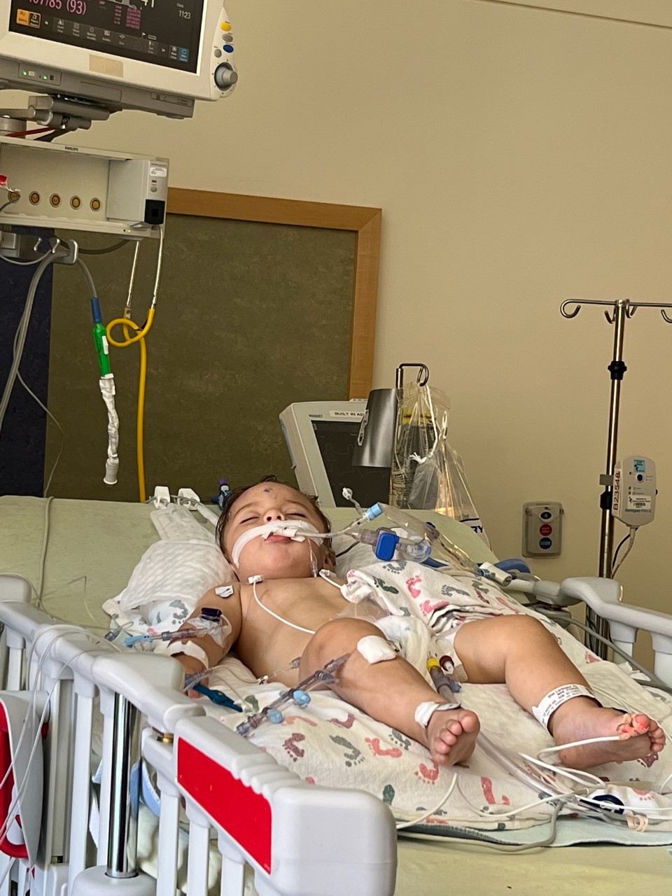 Alexander Thompson, 1, lies in a medically induced coma after being found unconscious by his mother Sharon Thompson, who gave him CPR before first responders arrived. (Courtesy of Katia Dorotik) (TimHursttim.hurst@gazette.comhttps://secure.gravatar.com/avatar/aca82bd62b4ee425c598527cd6faa1b1?d=mm&r=g)