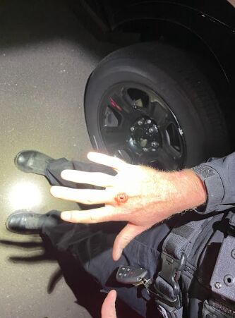 A photo of the knuckle of the CSPD officer who punched Dalvin Gadson. (Courtesy of The Law Offices of Harry Daniels)