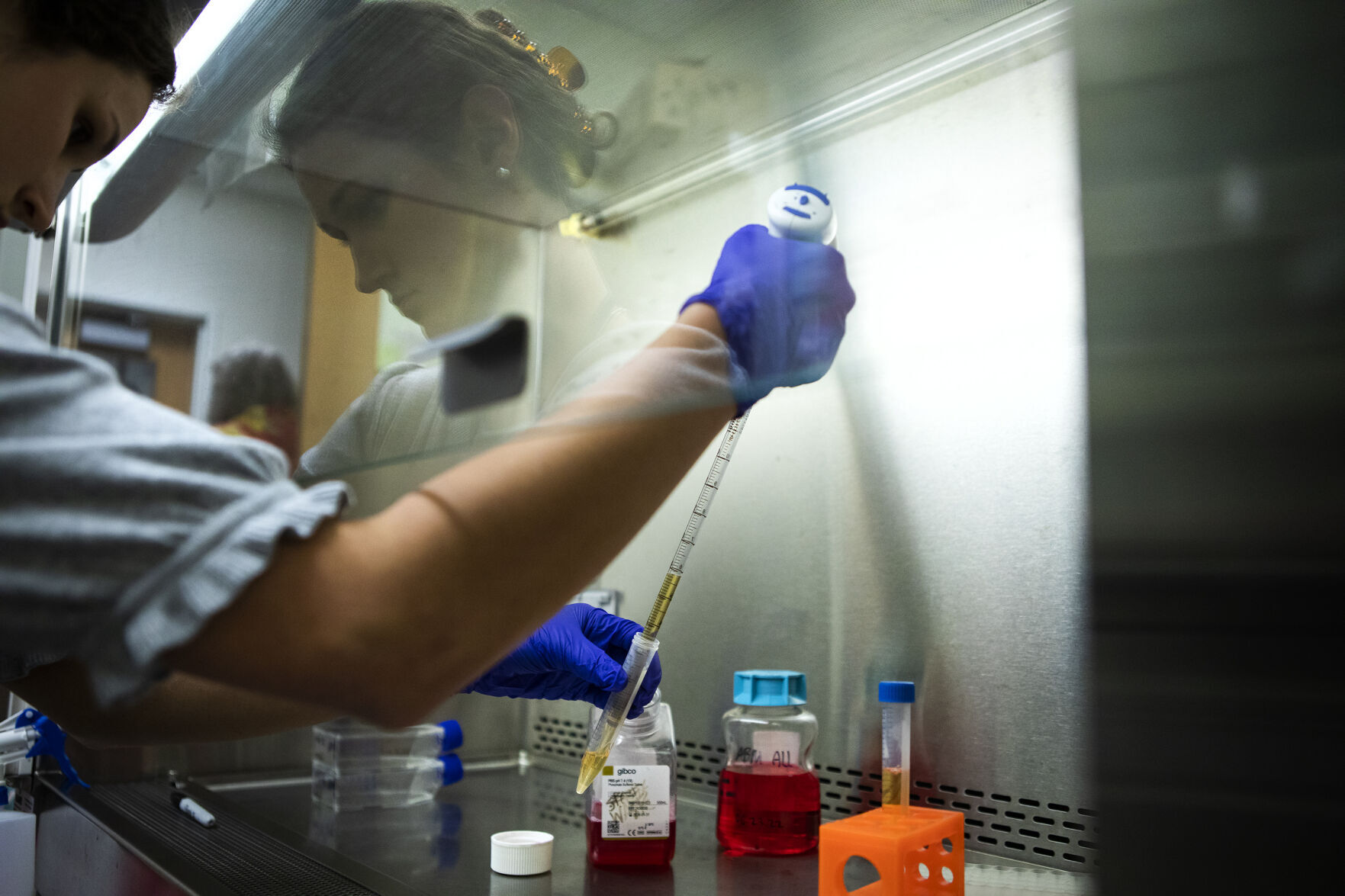 A University of Colorado Denver biomedical engineering student changes out the media used to grow tumor cells to be used for cancer research at the University of Colorado Anschutz Medical Campus in Aurora. (The Denver Gazette file)