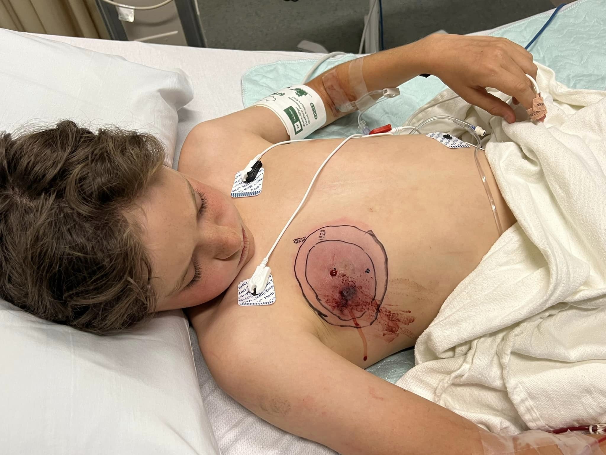 Ethan Vogel, 11, lies on a hospital bed at Anschutz Medical Center after being bitten by a rattlesnake while mountain biking on North Table Mountain in Golden, Colorado, Tuesday, June 6, 2023. (Courtesy, Zach Vogel)