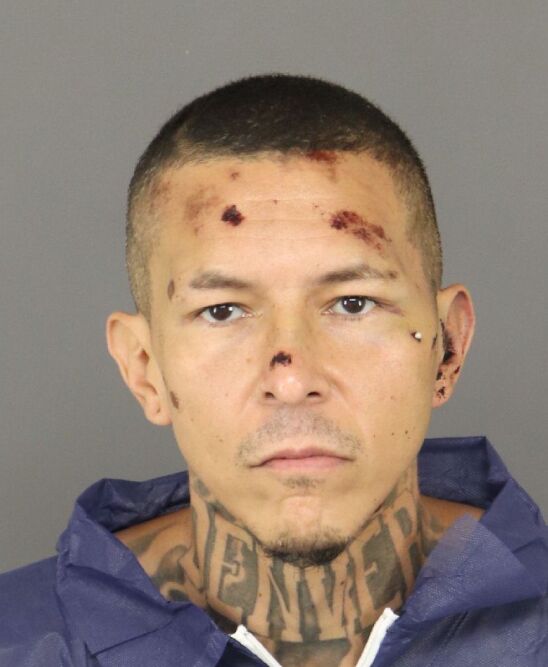 Suspect accused of shooting Adam’s County deputy faces multiple felony charges