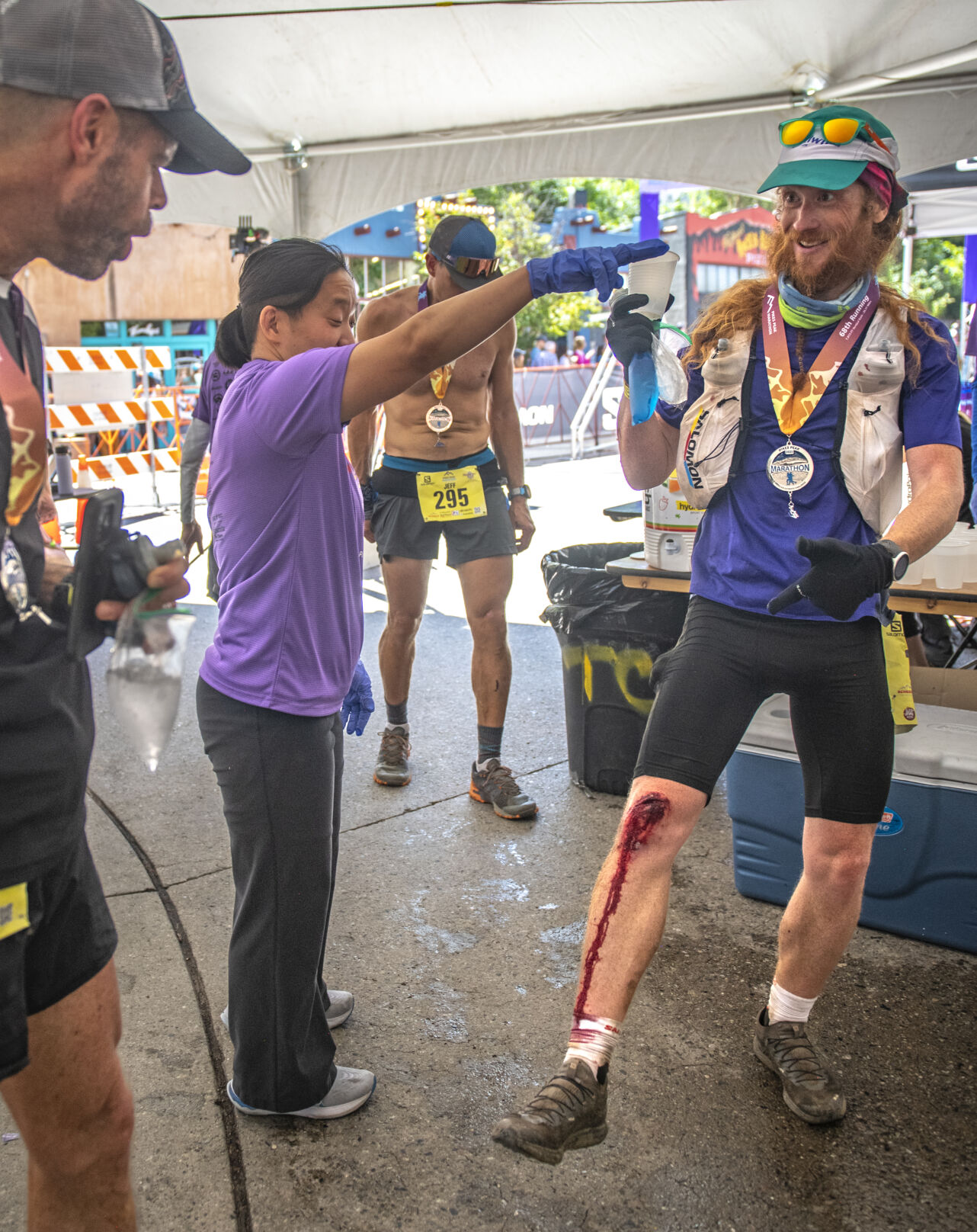 Pikes Peak Marathon finisher Rick Webb shows off his busted knee to a fellow finisher at the cooldown tent in Manitou Springs on Sunday, September 17, 2023. (Gabi Broekema)