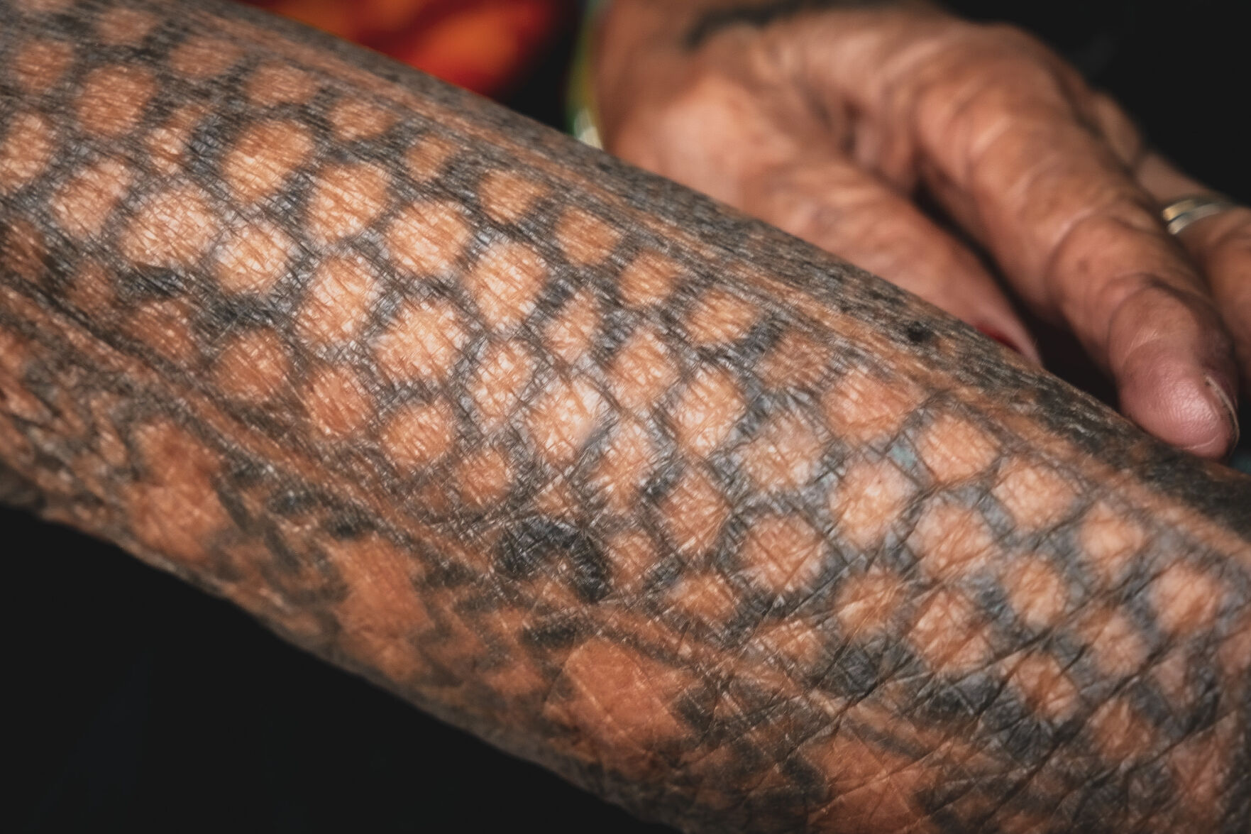 The tattooed skin of Whang-Od. Photo by Aria Brauchli, Special to The Gazette (Aria Brauchli, Special to The Gazette)