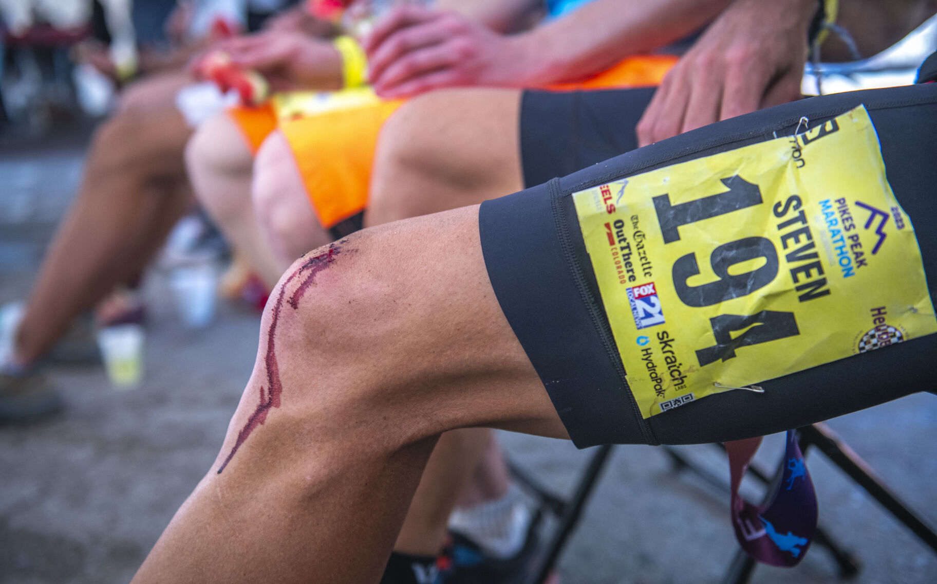 Pikes Peak Marathon finisher Steven Bacon cools down before receiving care for his cut open knees in Manitou Springs on Sunday, September 17, 2023. “I don’t know how, actually,” Bacon responded after being asked how he hurt his knee. (Gabi Broekema)