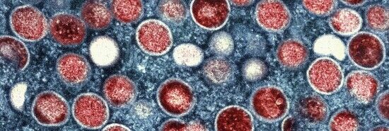WHO and CDC concerned about deadlier strain of mpox