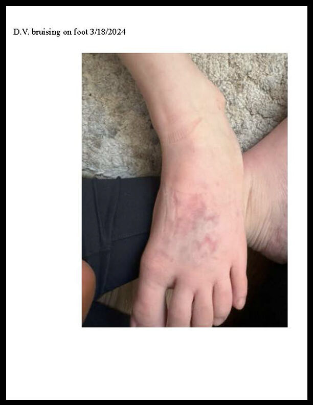 Alleged abuse of school kid on Littleton special needs bus uncovered