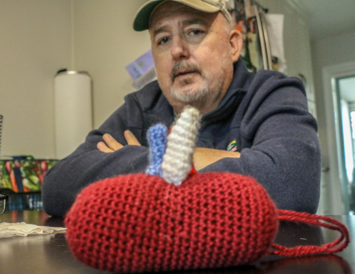 Transplant recipient Lee Anderson received a crocheted kidney from friend Laura Palmer after his surgery. (JOHN MOORE/DENVER GAZETTE)