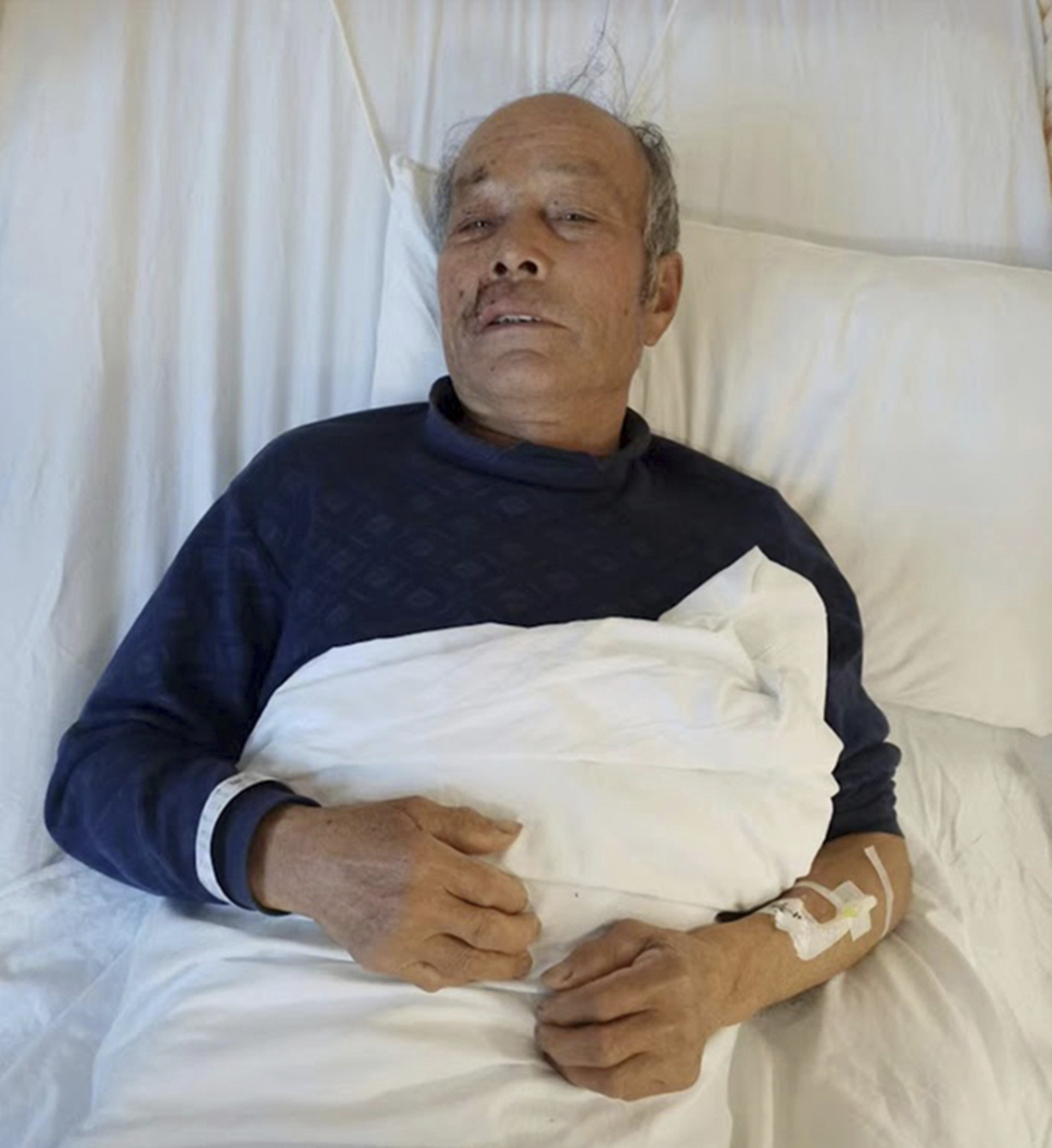 Yang Guoliang lays in a hospital bed after police beat him with bricks, Tuesday, March 12, 2024, in Changzhou in eastern China's Jiangsu Province. (Yang Family - Yang Family)
