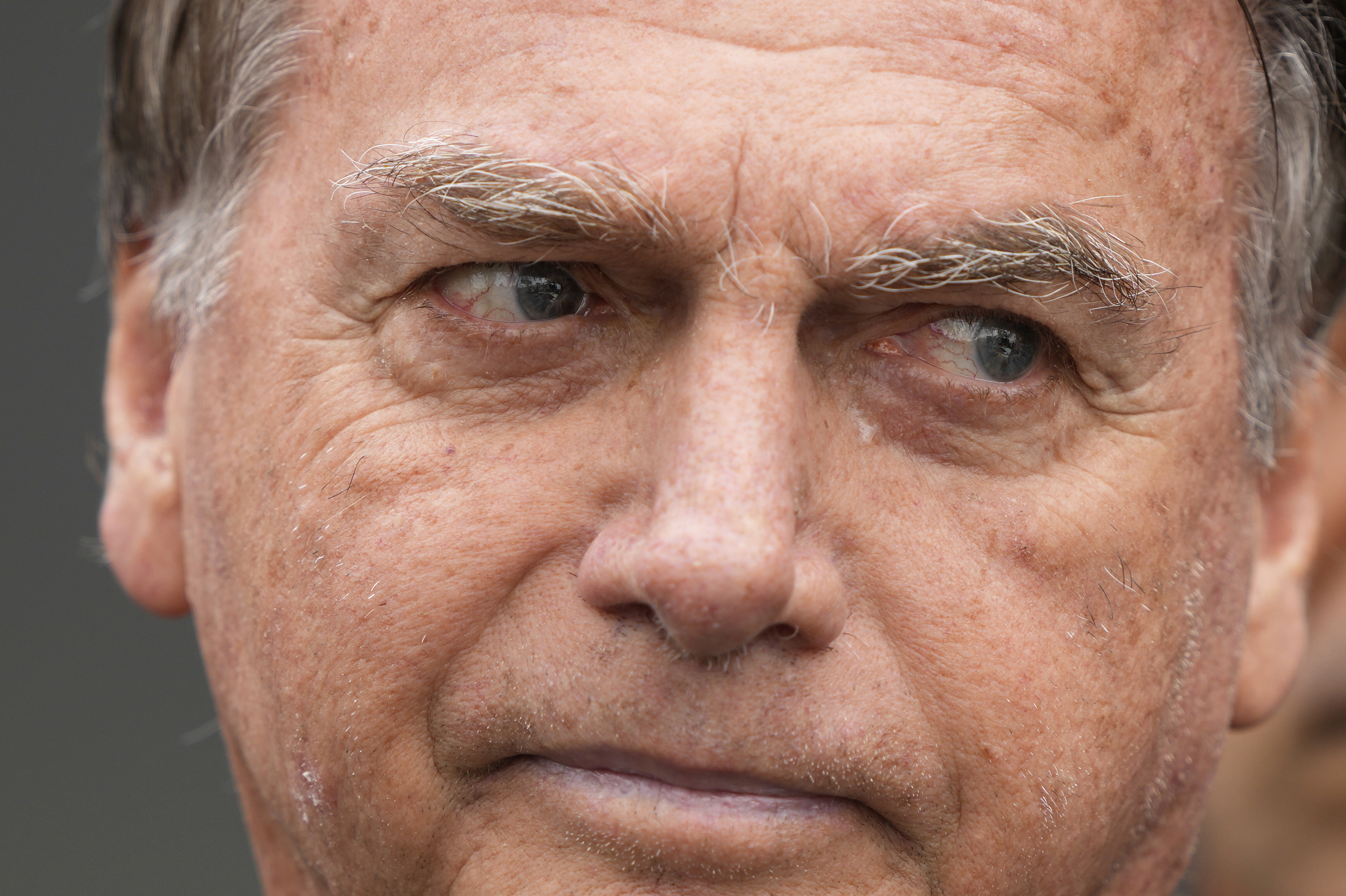 Former President Jair Bolsonaro, temporarily allowed out of house arrest for medical treatment, departs a hospital in Brasilia, Brazil, Sunday, Sep. 14, 2025. (Eraldo Peres - AP)