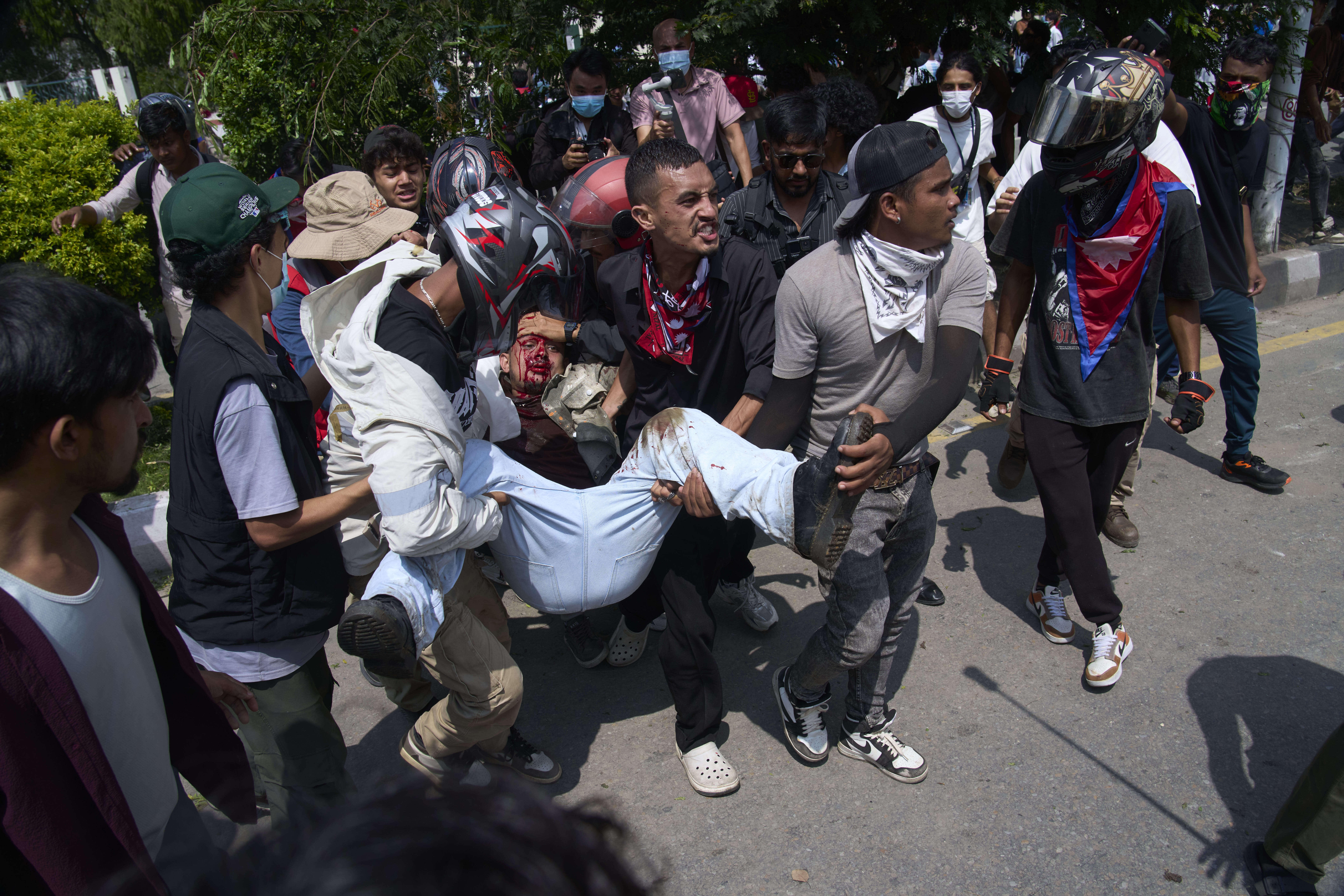 An injured protester is taken to hospital by his friends during a protest in front of the parliament building in Kathmandu, Nepal, Monday, Sept. 8, 2025. (Niranjan Shrestha - AP)