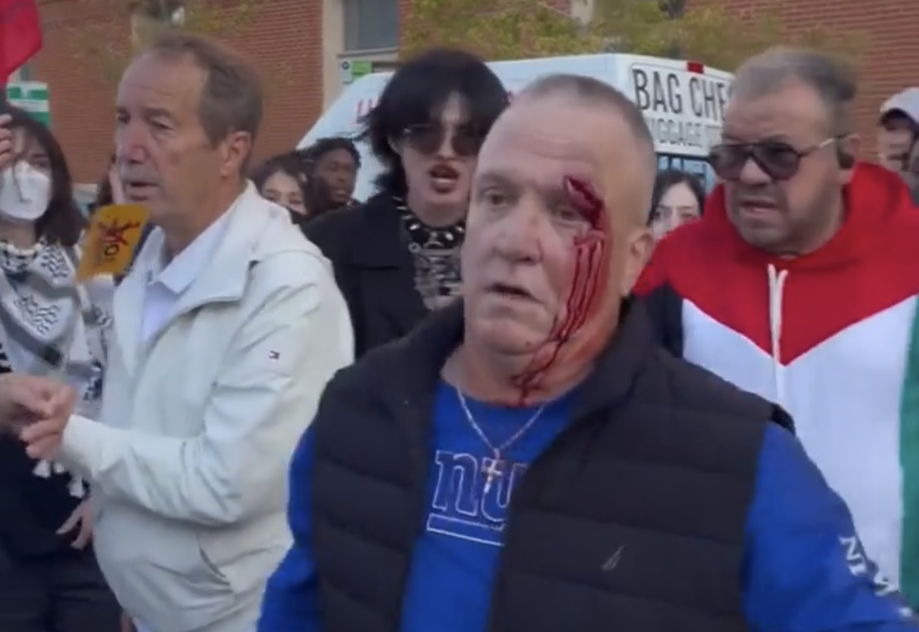 Denver man arrested for viral ‘No Kings’ rally tripping incident