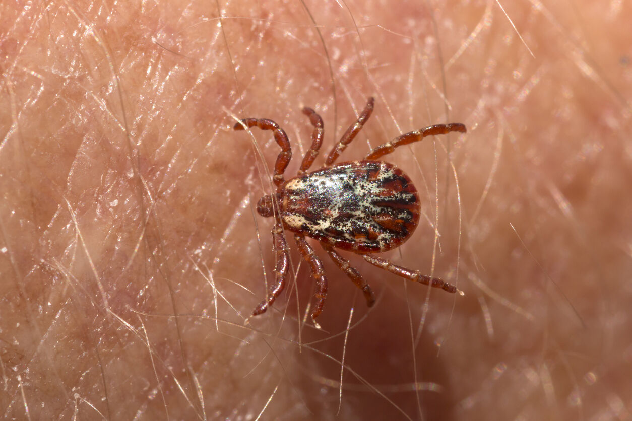 Vet says ticks carrying Lyme disease have made it to Colorado