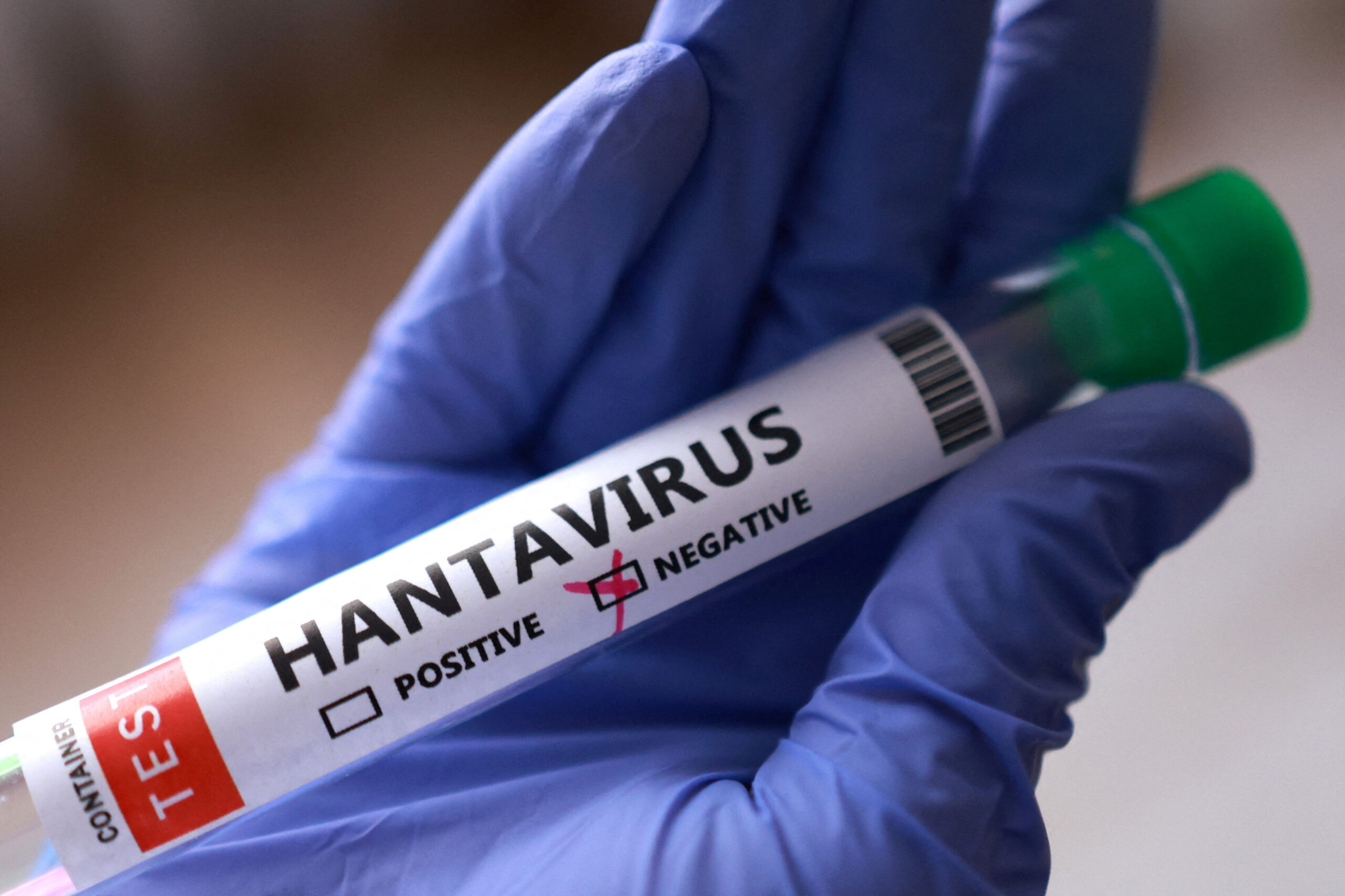Colorado health officials confirm deadly hantavirus case